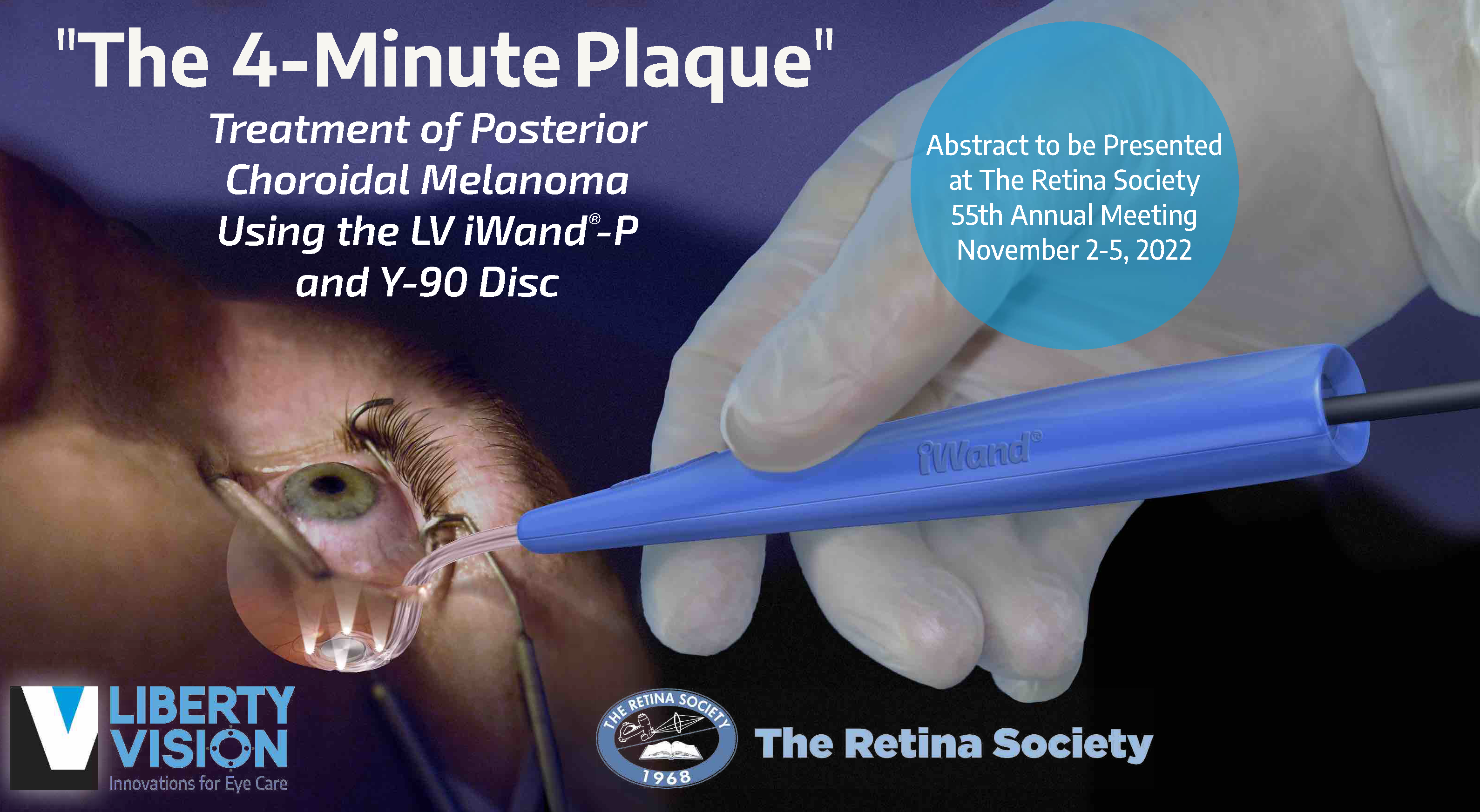 The 4-minute plaque - LV Y-90 disc at Retina Society