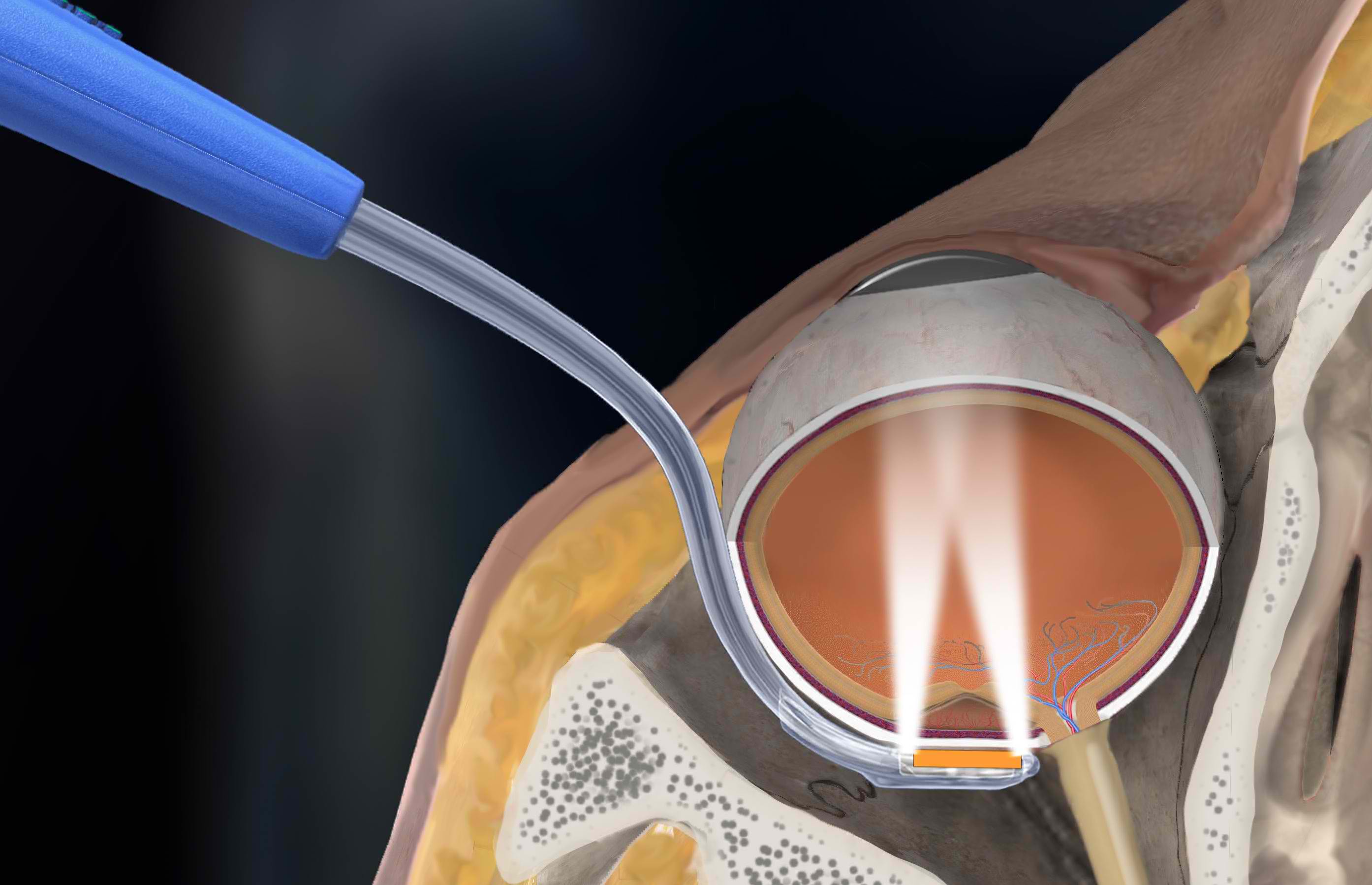 Liberty Vision physics testing